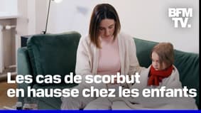 Surnommé "pêcher souvent"pourquoi le scorbut fait-il son retour en France ? 