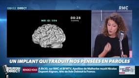 Un implant qui traduit nos pensées en paroles - c'est déjà demain