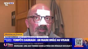Seine-Maritime: ce maire d'une petite commune a été brûlé par un retour de flamme lors du passage de la tempête Darragh