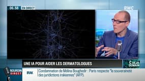 Une IA pour aider les dermatologues