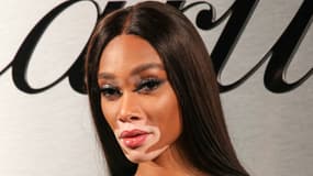 La mannequin Winnie Harlow, atteinte de vitiligo, arrive sur le tapis rouge pour le lancement de la montre Santos de Cartier au Pier 48 le 5 avril 2018 à San Francisco,