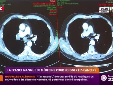 La France manque de médecins pour soigner les cancers