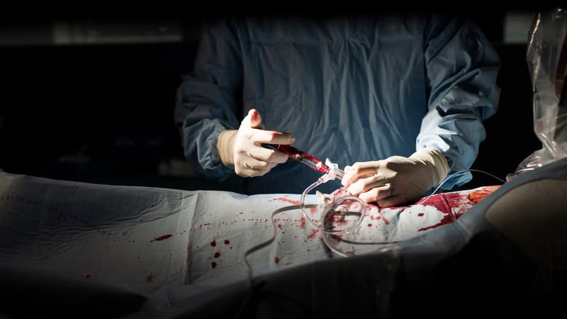 Un chirurgien opère un patient à l'hôpital d'Argenteuil, le 19 juillet 2013. (photo d'illustration)