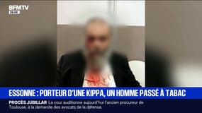 Un homme de 67 ans victime d'une violente agression antisémite dans l'Essonne