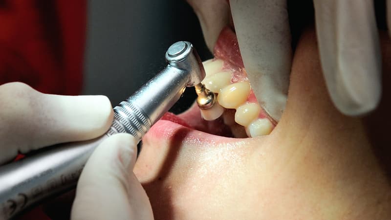 La justice néerlandaise autorise une éventuelle extradition du "dentiste de l'horreur" vers la France (photo d'illustration).