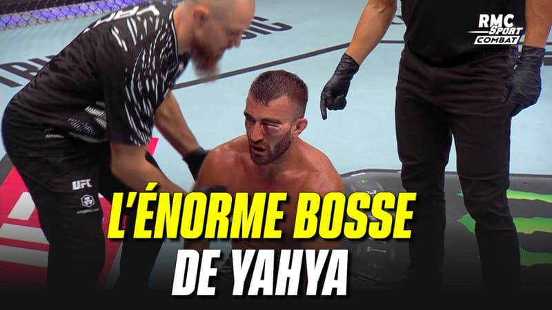 https://images.bfmtv.com/LpzAgd36CA6UozpD_0yql8eNpmo=/0x0:1280x720/800x0/images/UFC-Abu-Dhabi-La-gigantesque-bosse-sous-l-oeil-d-un-combattant-emirati-2116348.jpg