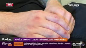 Rodéos urbains: la toute-puissance des participants