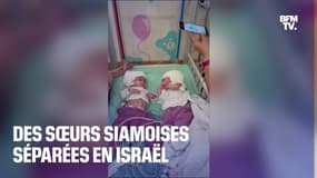 Après 12 heures d'opération, des sœurs siamoises ont été séparées 