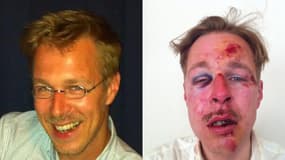 Wilfred de Bruijn, à gauche, a posté sur Facebook une photo de lui après l'agression.