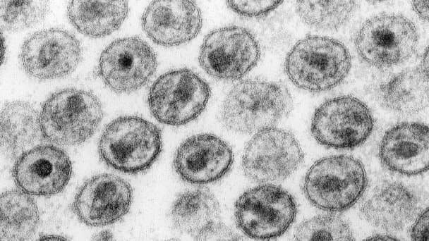 Le virus du VIH vu au microscope électronique. Photo d'illustration