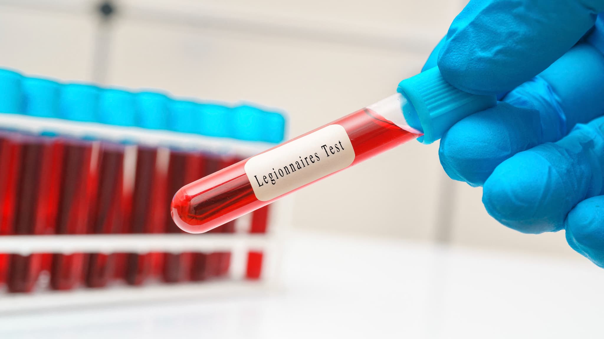 LE NOMBRE DE CAS DE LÉGIONELLOSE GRIMPE À 45 EN SAVOIE, HUIT PERSONNES HOSPITALISÉES EN RÉANIMATION