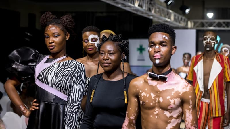 La créatrice Monica Khatokho, au centre, entouré de deux mannequins ayant participé au défilé "Mes cicatrices sont belles", samedi 22 octobre.