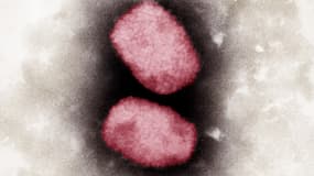 Une photographie microscopique du virus de la monkeypox.