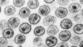 Le virus du VIH vu au microscope électronique. Photo d'illustration