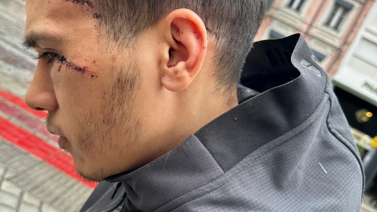 Samir a grièvement été blessé après avoir été agressé au couteau à bord d'un TER, à Mulhouse, mardi 5 mars. Samir a grièvement été blessé après avoir été agressé au couteau à bord d'un TER, à Mulhouse, mardi 5 mars.