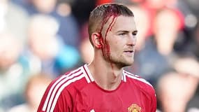 Matthijs de Ligt la tête ensanglantée lors de Manchester United-Brentford, le 19 octobre 2024.