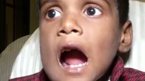 À 7 ans, ce jeune indien s'est fait retirer 526 dents