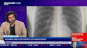 Tech for Good Awards: les candidats de la catégorie « Santé & Handicap » - 09/05