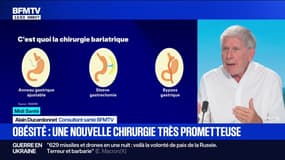 Une nouvelle chirurgie très prometteuse pour lutter contre l'obésité