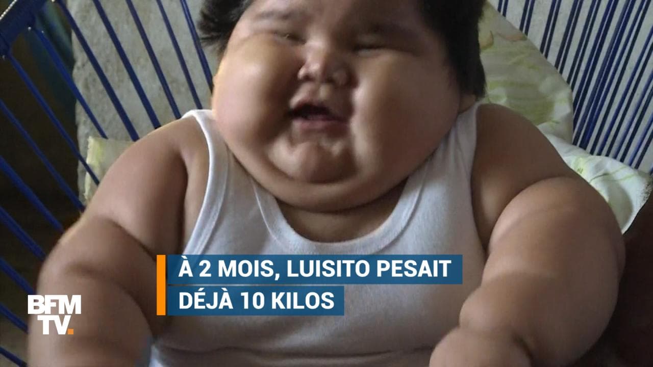 Ce Bebe Mexicain De 10 Mois Pese Deja 28 Kg