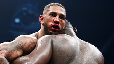 Tony Yoka, en sang, lors de sa défaite en mai 2022 contre Martin Bakole, l'un des plus gros puncheurs de la division des lourds.