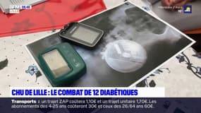 CHU de Lille: le combat de 12 diabétiques bientôt privés de pompes à insulines