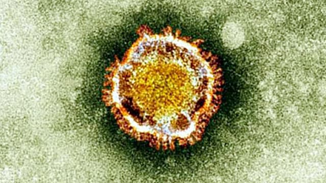 Le coronavirus vu au microscope - Image d'illustration