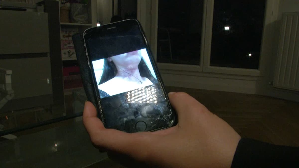 placeholder video