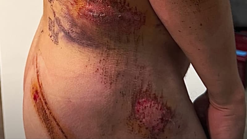 Les stigmates impressionnants de la chute de Michal Kwiatkowski sur Milan San Remo 2259813