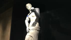 Une réplique de la Vénus de Milo a été équipée de prothèses.