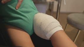 Brulure à la soude : la mère de la victime témoigne 