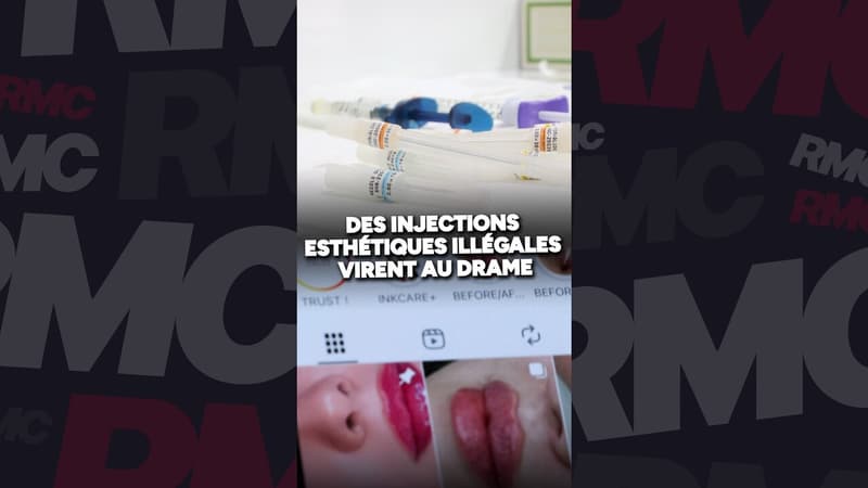 Des injections esthétiques illégales virent au drame
