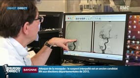 Qu'est-ce que la thrombectomie mécanique, cette technique qui révolutionne la prise en charge de l'AVC?