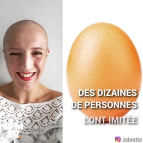 Avec le #EggHeadChallenge, elles postent leurs visages pour aider la lutte contre le cancer