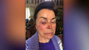 Dominique Tapie, blessée lors d'un violent "home jacking", le 5 avril 2021.