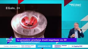 C’est quoi le progrès ? : La première prothèse d'œil imprimée en 3D - 29/11