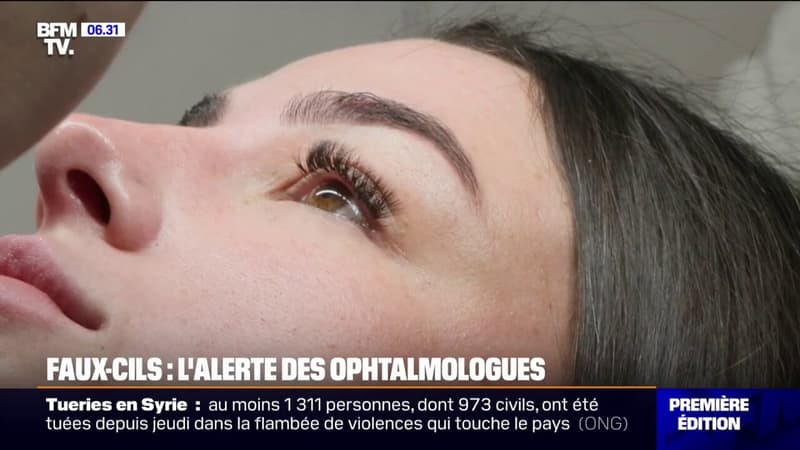 Rougeur, démangeaison...Les ophtalmologues alertent sur les extensions de cils mal réalisées