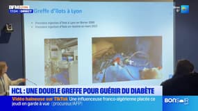 HCL: une double greffe pour guérir du diabète