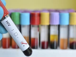 VIH: une patiente en rémission après une allogreffe, une première en France