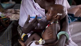 Un enfant souffre de malnutrition dans un camp de MSF au Soudan du sud, le 3 mars 2014.