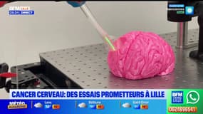 Un essai clinique pour combattre le cancer du cerveau au CHU de Lille.