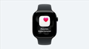 Détection de l'hypertension dans la Watch Series 11