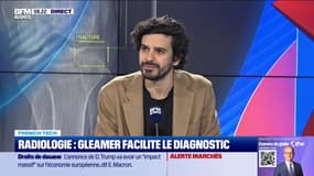 French Tech : Radiologie, Gleamer facilite le diagnostic - 04/04