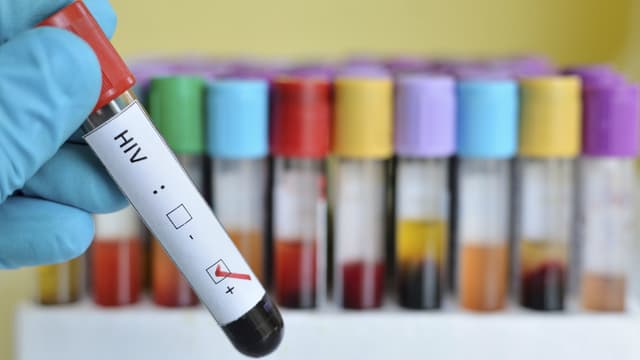 Des tests de dépistage du VIH - Image d'illustration
