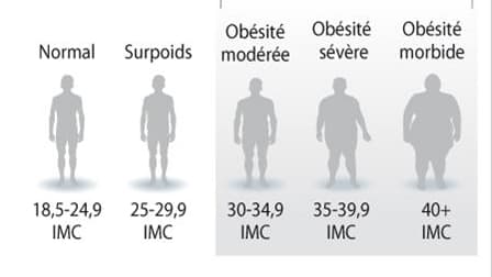 LES NIVEAUX D'OBÉSITÉ