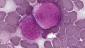 Cellules leucémiques