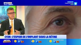 Lyon : l'espoir de l'implant sous la rétine donne un nouvel espoir contre la DMLA