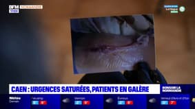 Caen: urgences saturées, patients en galère
