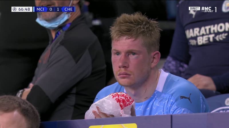 Euro: De Bruyne opéré et forfait pour Belgique-Russie