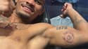 André Lima s’est fait tatouer la trace la morsure infligée à l'arrière de son bras par Igor Severino (UFC Fight Night Las Vegas), le 23 mars 2024